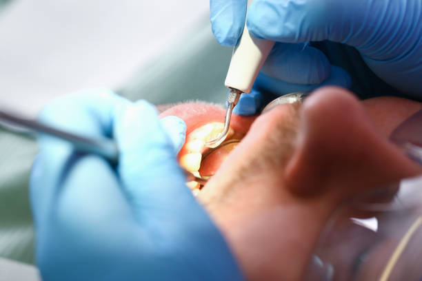 Best Broken or Chipped Tooth Repair in Farmville, VA